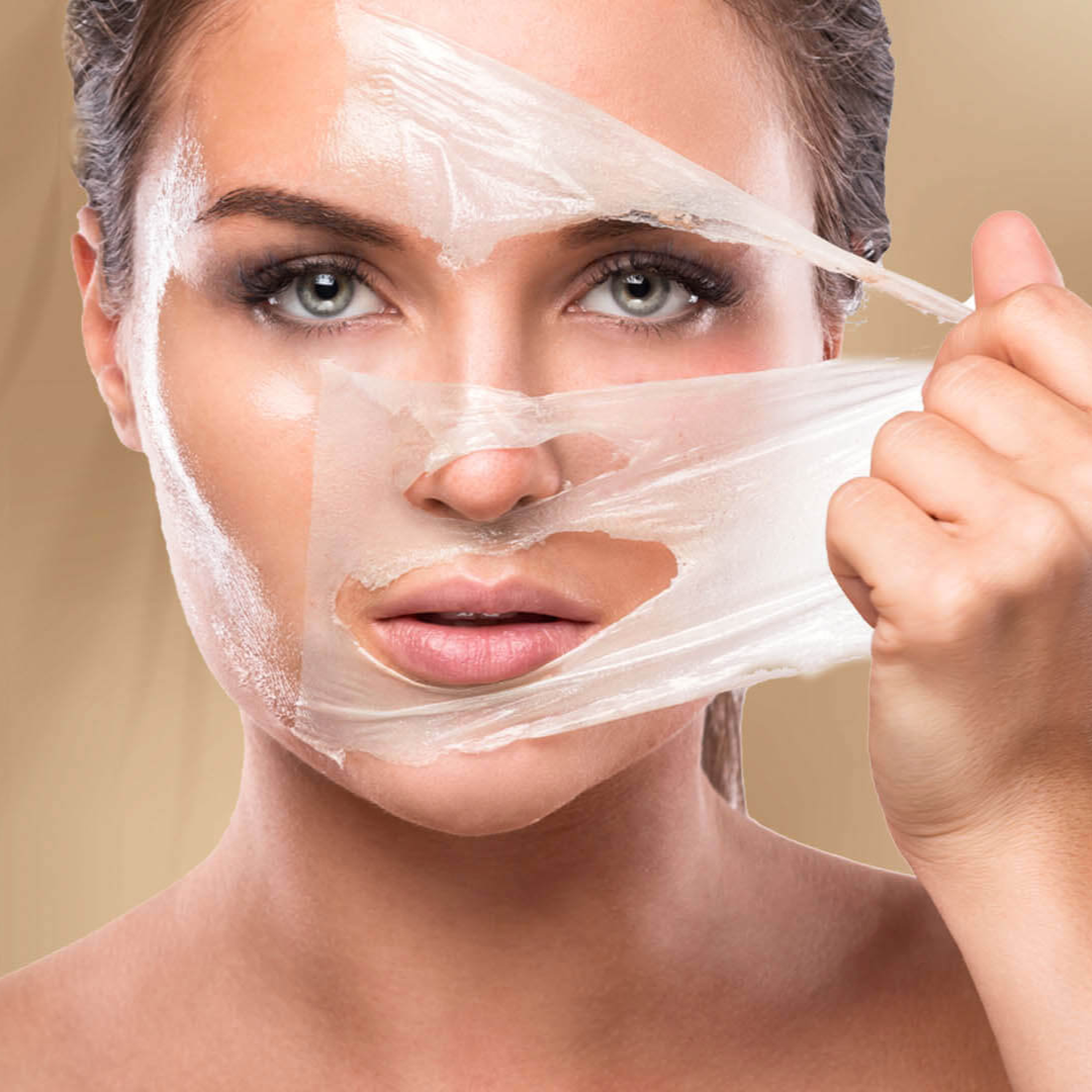 Peeling Químico