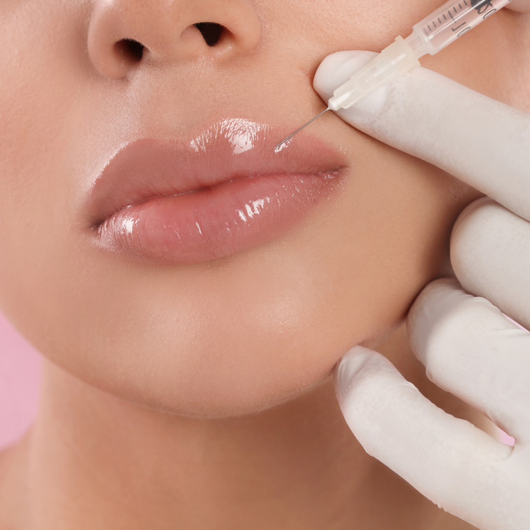 Preenchimento Labial