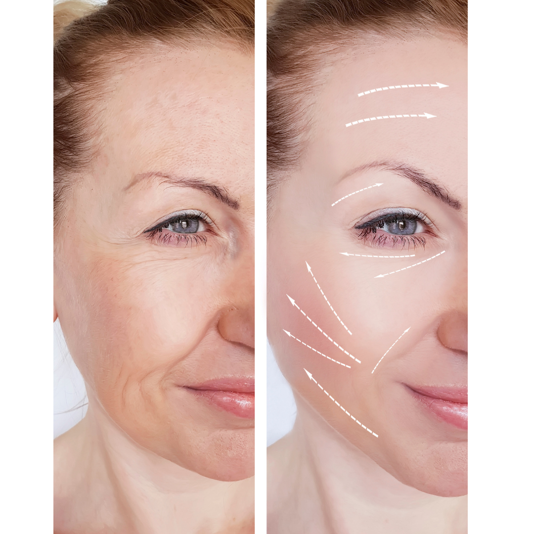 Rejuvenescimento Facial