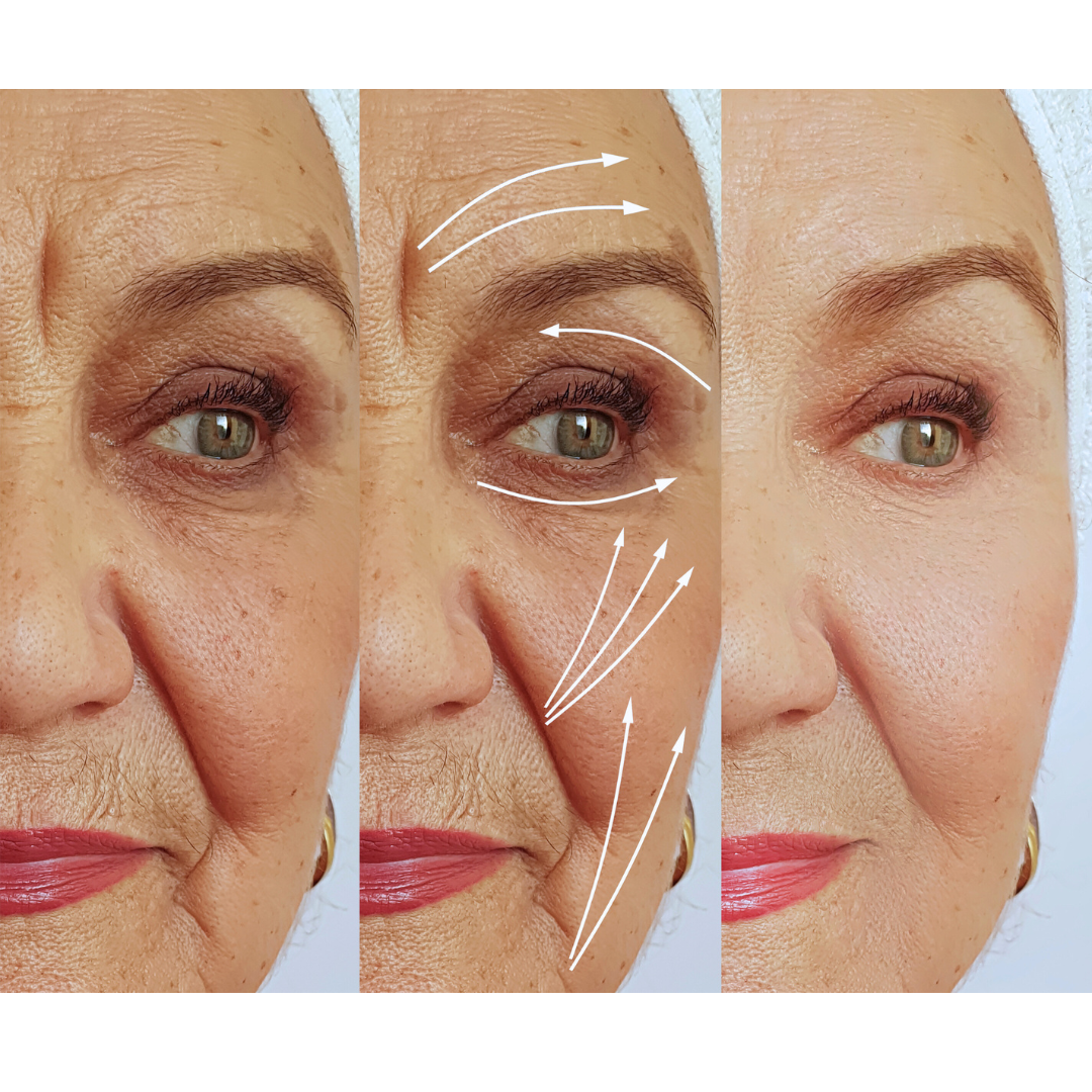 SkinBooster